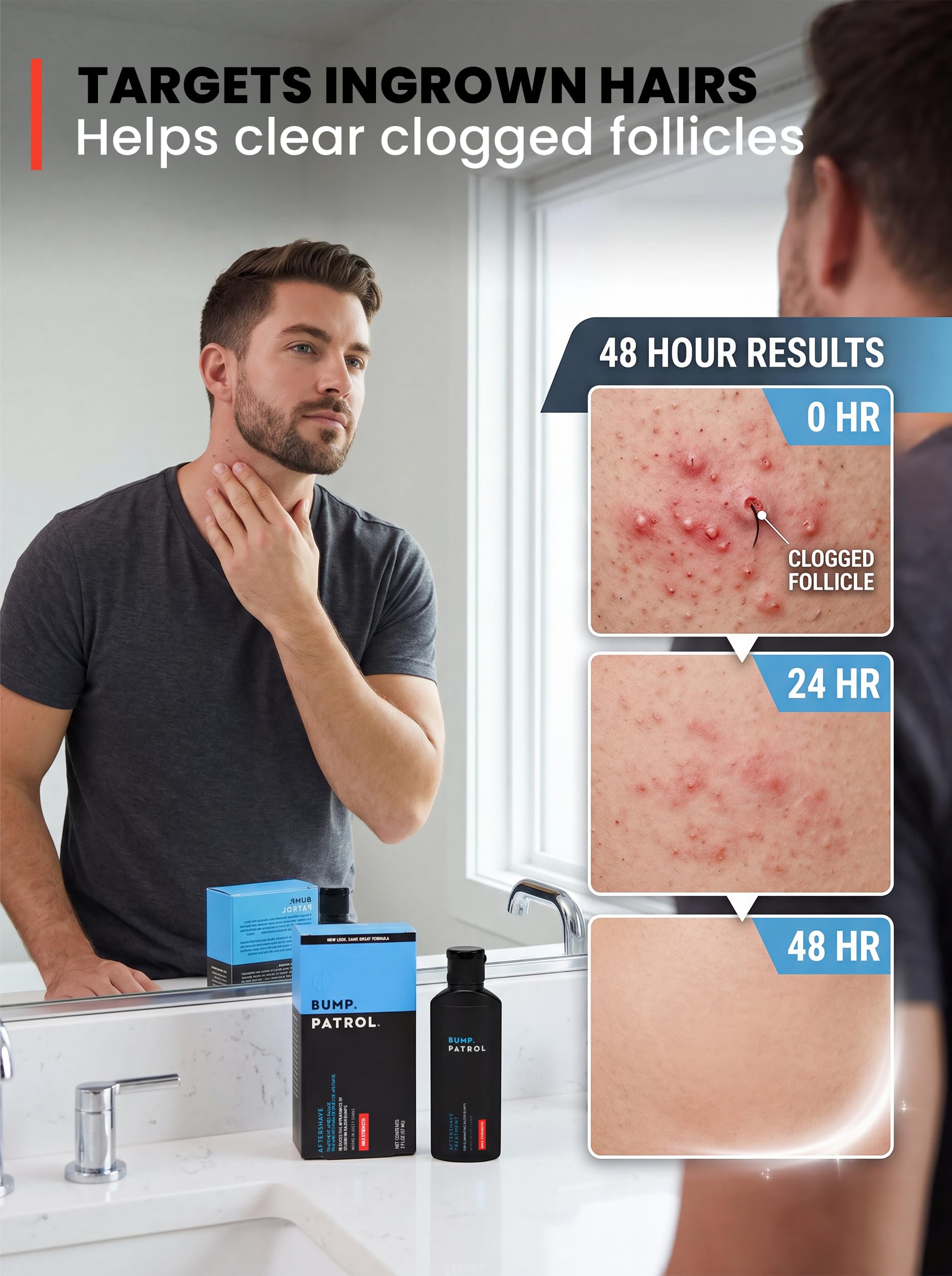 Bump Patrol Maximum Strength Aftershave Treatment Serum – Razor Bump Stopper and Ingrown Hair Treatment for Men and Women, Fast Acting Salicylic Acid for Razor Burn & Shaving Irritation - 2 oz Pack 4
