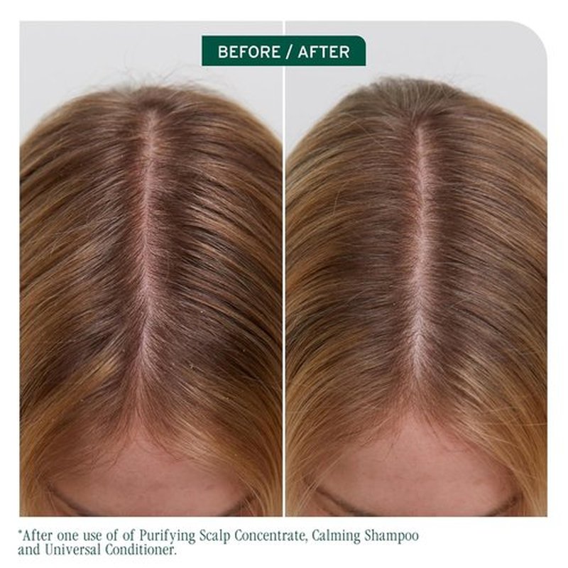 Biolage Scalp Sync Universal Conditioner - Nourishing Hydration for All Scalp Types | Lightweight & Vegan