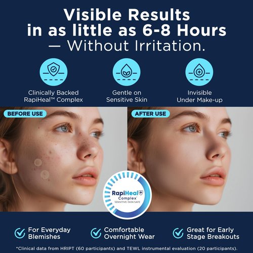 Pimple Patches for Face - 134 Count Hydrocolloid Acne Patches - Zit, Blemish, Cystic Acne Dots & Dark Spot Treatment - Invisible Clear Pimple Patch Stickers for Forehead, Chin, Nose, 3 Sizes (S, M, L)