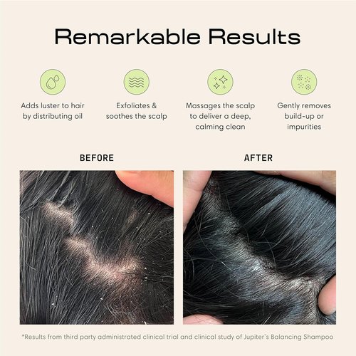 Jupiter Scalp Exfoliator - Ergonomic Scalp Massager & Dandruff Comb - Black/White Design for All Hair Types