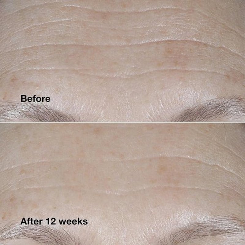Clinique Smart Clinical Repair Cream - Wrinkle Correcting with Peptides & SPF 30 | Hydrating Formula