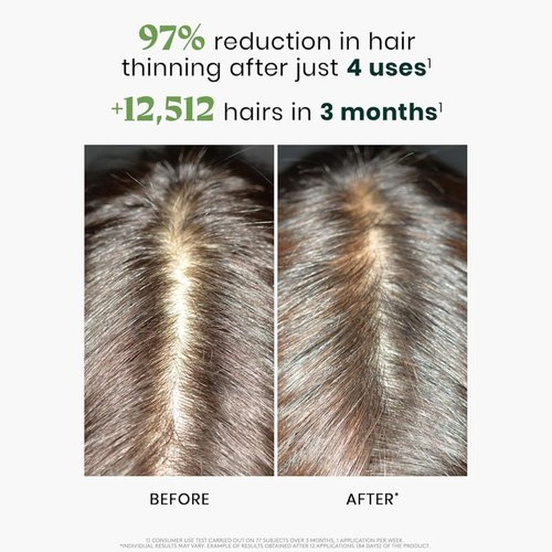 Rene Furterer Triphasic Concentrated Serum | Drug-Free Solution for Thinning Hair - 12 ct., 3-Month Supply
