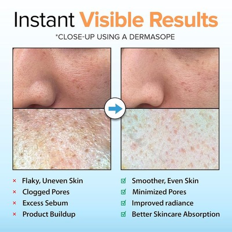 Ebanel Brightening Peeling Gel - Gentle Exfoliating Face & Body Scrub with Rice, Papaya & Hyaluronic Acid