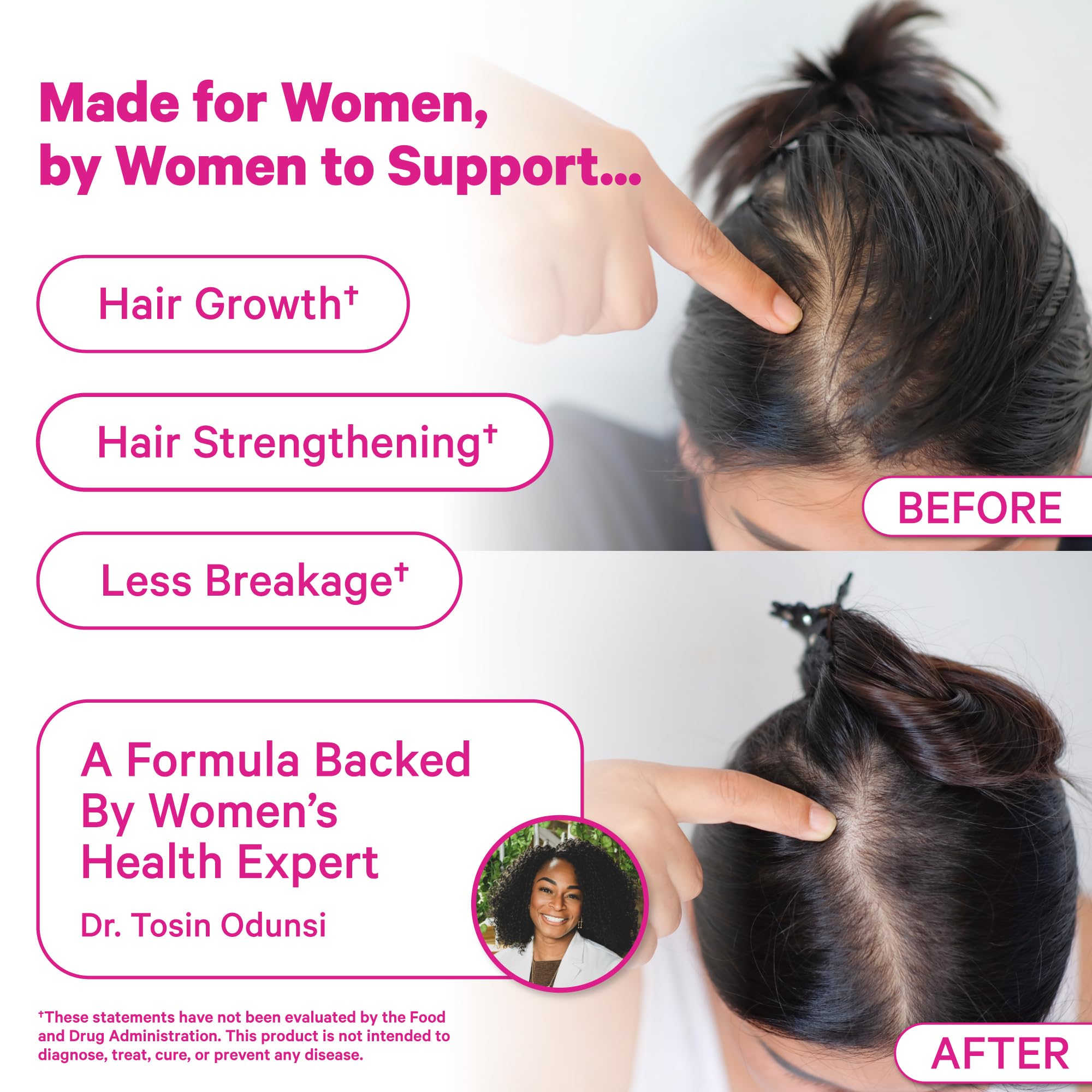 Pink Stork Postpartum Hair Loss Gummies | Biotin, Pantothenic Acid, Vitamin E, B6, B12 | Postnatal Hair Growth + Regrowth Support | Breastfeeding-Friendly | Postpartum Essentials | 60 Gummies