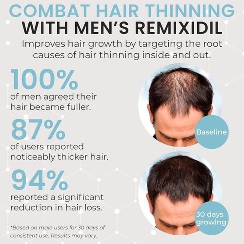 Hair Growth Vitamins - Regrow Hair for Men | Strengthens Beard & Scalp | Reduces Thinning | 60 Fast-Acting Capsules