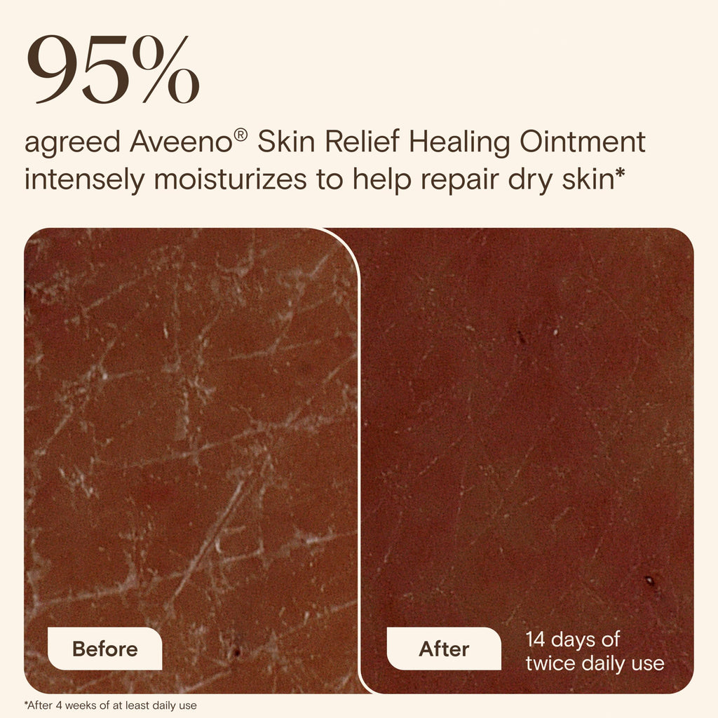 Aveeno Skin Relief Healing Ointment, for Extra Dry, Cracked & Sensitive Skin, 72-Hour Protectant with Triple Oat, Shea Butter & Glycerin, Fragrance-Free for Body, Face, Hands, Lips 7.2 oz