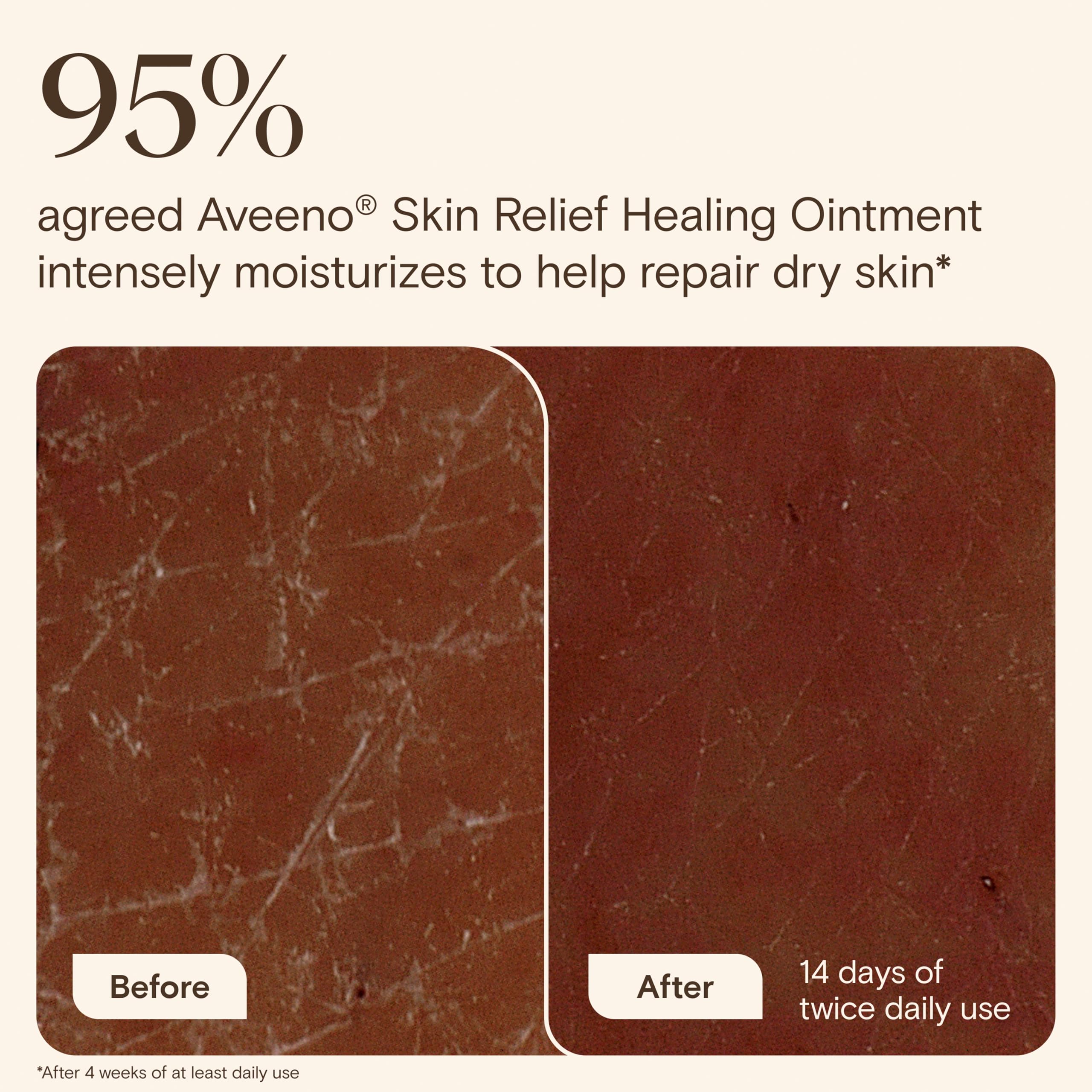 Aveeno Skin Relief Healing Ointment, for Extra Dry, Cracked & Sensitive Skin, 72-Hour Protectant with Triple Oat, Shea Butter & Glycerin, Fragrance-Free for Body, Face, Hands, Lips 7.2 oz