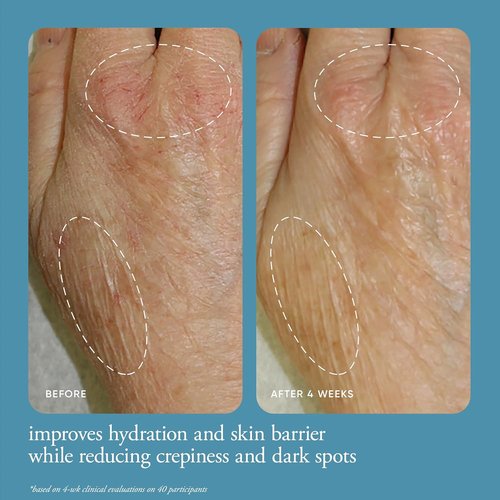 Philosophy In Good Hands Multi-Restorative Hand Cream - Vitamin C & Niacinamide for Plump, Smooth Skin - Reduces Dark Spots, Non-Greasy Formula