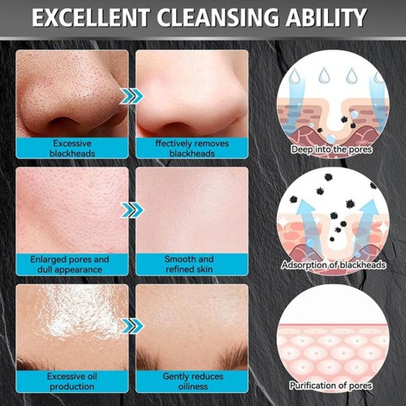 Skiennix Charcoal Peel Off Mask - Deep Cleansing Blackhead Remover for Face & Nose, 4.23 OZ