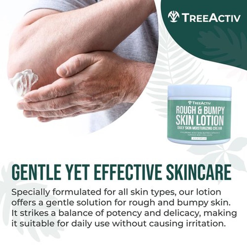TreeActiv Rough and Bumpy Skin Lotion, 8 fl oz, With Hyaluronic Acid, Shea Butter and Vitamin E, Nourishing Lotion for Rough and Bumpy Skin, Moisturizing Strawberry Legs, For All Skin Types