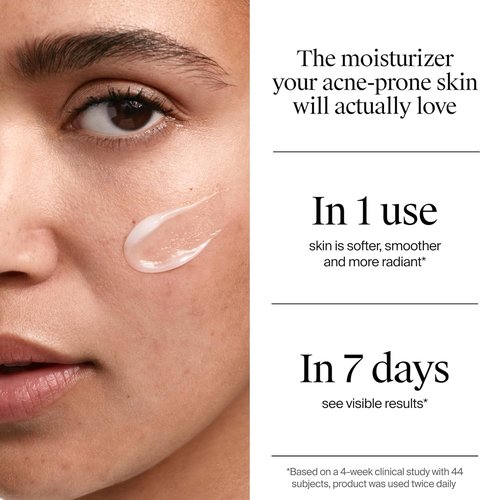 Neutrogena Evenly Clear Acne Gel Moisturizer - Lightweight Formula with Salicylic Acid & N-Acetyl Glucosamine | 1.7 fl. oz