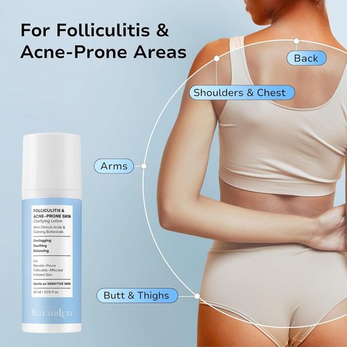 BellamiLuxx Folliculitis Acne Lotion - Soothes Itch & Redness, Reduces Body Acne & Bumps | Gentle Formula with Salicylic & Glycolic Acid