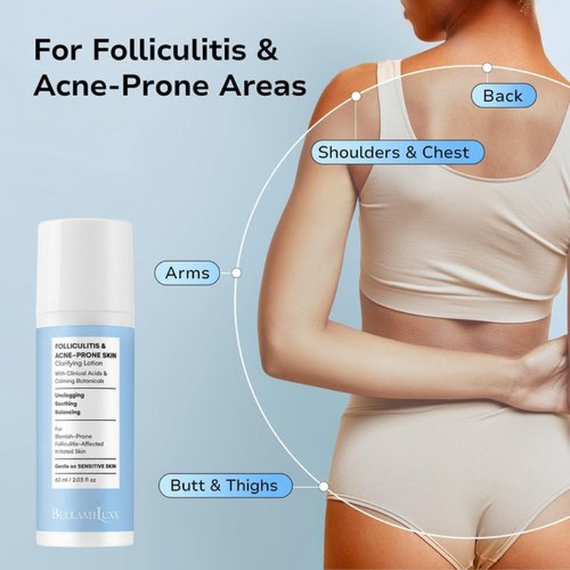 BellamiLuxx Folliculitis Acne Lotion for Body: Helps Reduce Itch, Redness, Body Acne, Bumps & Uneven Texture with Salicylic & Glycolic Acid + Botanicals - Gentle Care for Folliculitis-Prone Skin