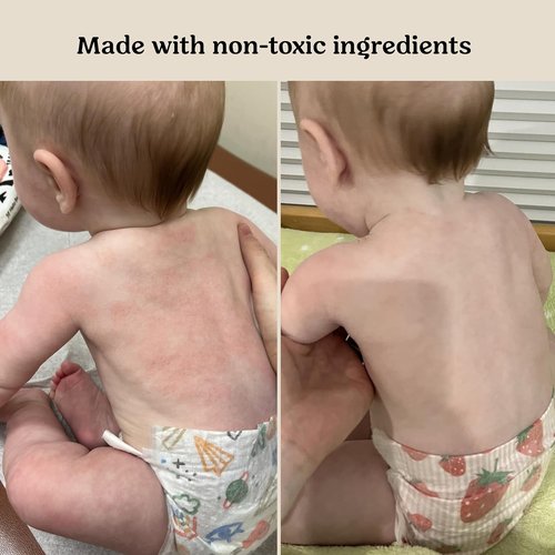 Roe Wellness Baby Cream & Serum Power Pair - Hydrating Skincare for All Ages | Body & Face Care for Toddlers & Newborns