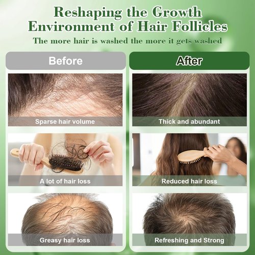 Batana Oil Shampoo -Promote Hair Growth,Rosemary Shampoo,Nourishes Scalp, Reduces Breakage & Adds Shine,Reduces Hair Loss (Batana Shampoo-(10.1 fl oz))
