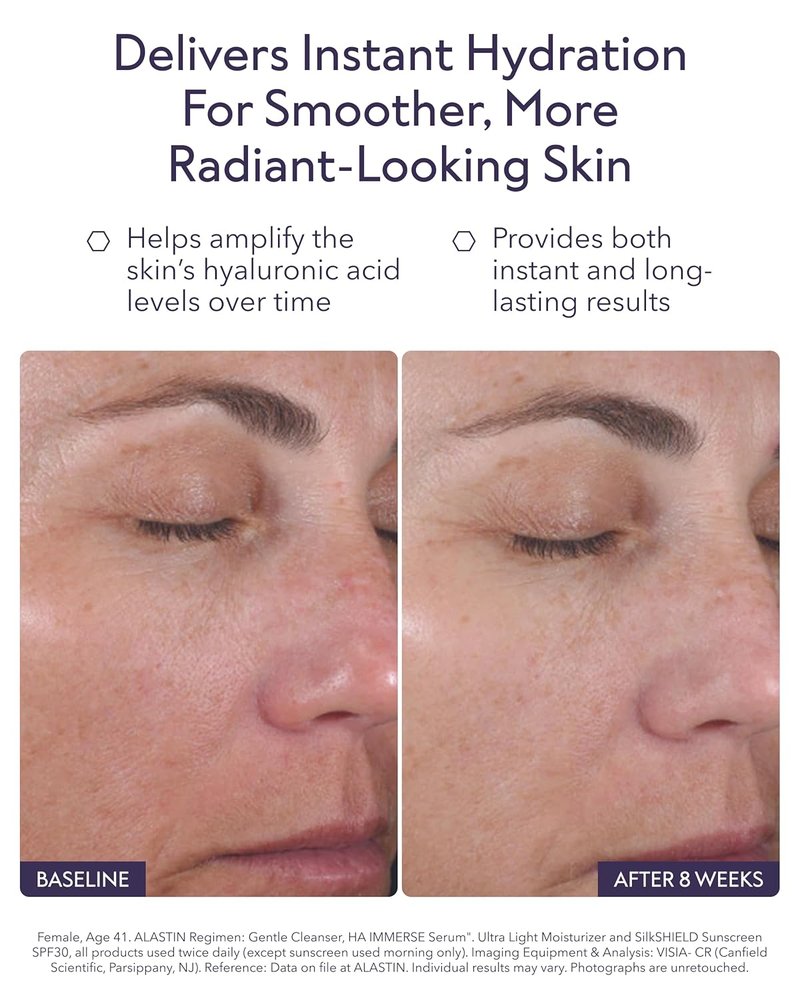ALASTIN Skincare Hyaluronic Acid Face Serum - Restorative Moisturizer for Radiant Skin (1 oz)