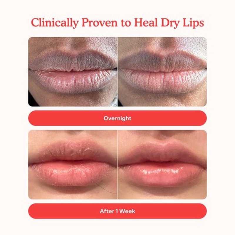 Tower 28 LipSoftie Tinted Lip Balm Treatment - Hydrating Glossy Balm + Overnight Lip Mask with Jojoba Oil + Shea Butter - Sweet, Cushiony Formula for Smooth, Soft Lips - Red Bean Mochi (0.38 oz)