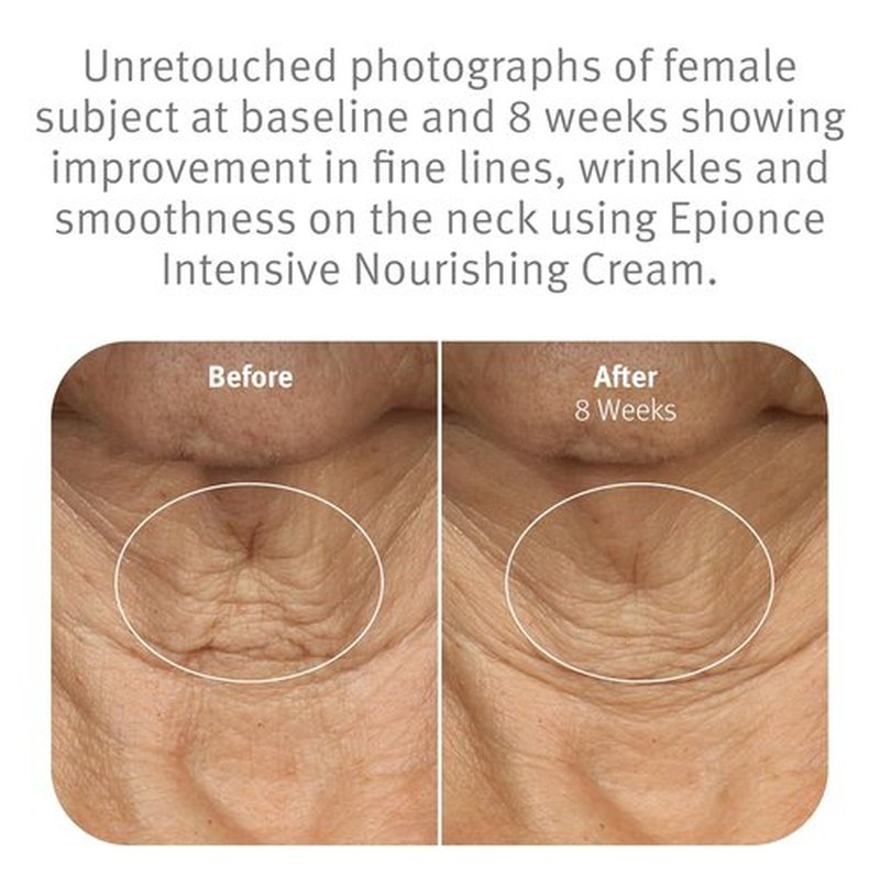 Epionce Intensive Nourishing Cream - Rich Anti-Aging Moisturizer for Face, Neck & Décolletage | Hydrates with Ceramides & Squalene | Reduces Fine Lines & Dark Spots
