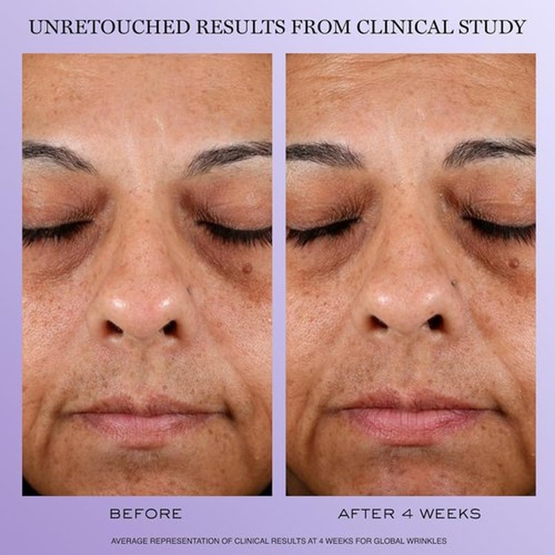 Lancôme Rénergie H.C.F. Triple Serum & H.P.N. 300-Peptide Face Cream Duo - Visibly Reduces Sagging, Wrinkles & Dark Spots