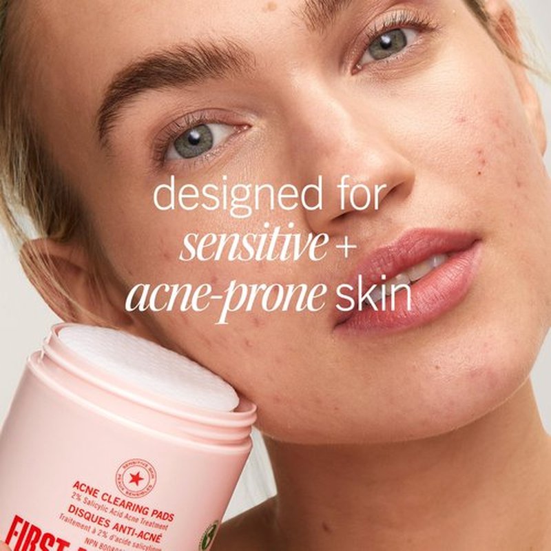 First Aid Beauty Acne Pads for Face - Maximum Strength Acne Treatment - 2% Salicylic Acid Pads Treat Without Drying, (60-ct)