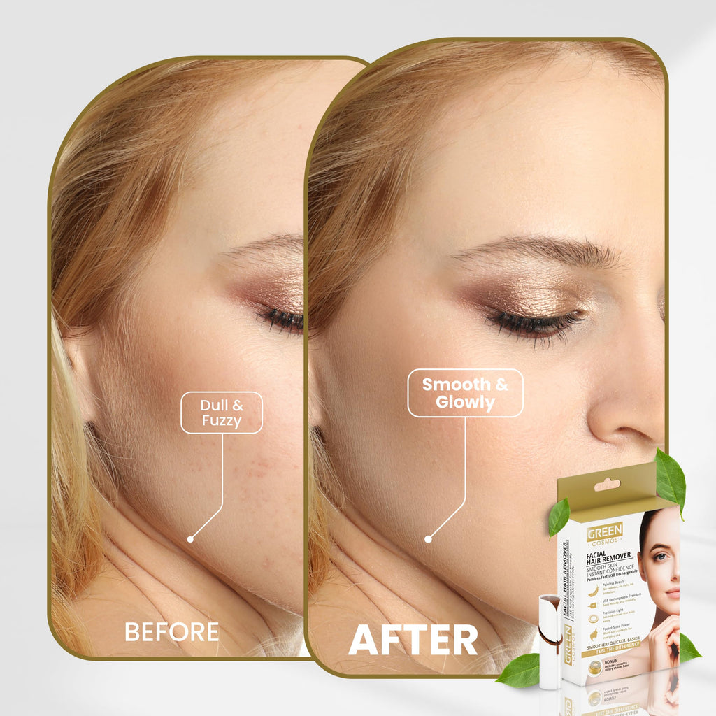 Facial Hair Remover for Women – Gentle & Painless Removal for Peach Fuzz, Lip & Chin – USB Rechargeable