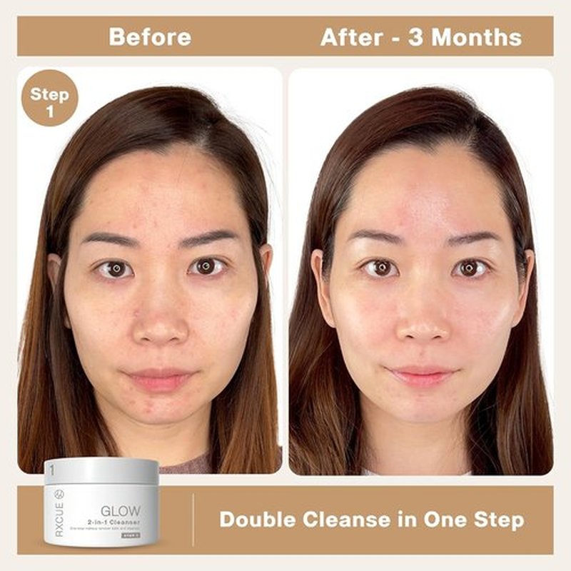 Rxcue Glow Travel Size Korean Skincare Set - 3-Step K-Beauty Kit for Glass Skin | TSA Approved, 1.01 fl oz Each