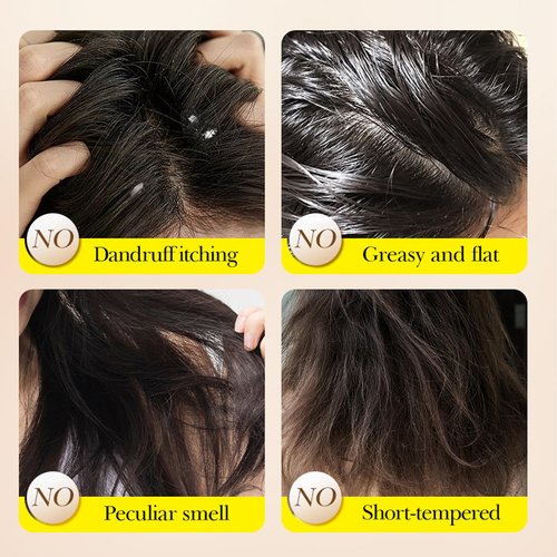 Grospe Lavender Essential Oil Shampoo Bar - Deep Cleansing & Moisturizing | Relieves Itching & Dandruff