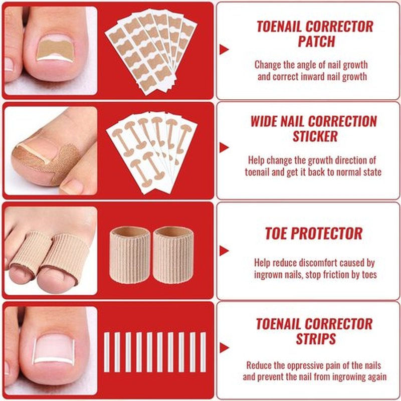 Ingrown Toenail Removal Kit, Ingrown Toenail Tool Kit with Ingrown Toenail Corrector, Ingrown Toenail Drops, Corrector Patch, Toenail Clipper, Nail File Lifter Tools