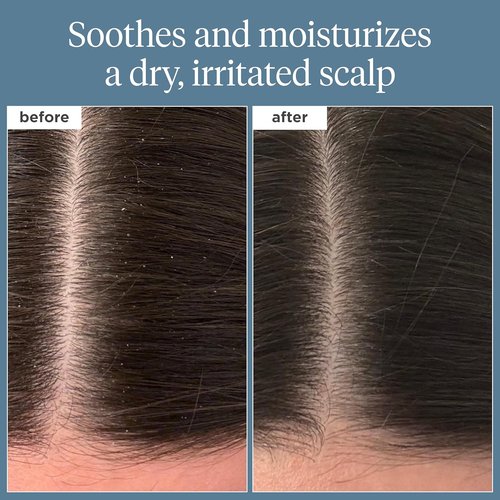 Briogeo Scalp Revival Rosemary Pre-Wash Oil - Moisturizing Treatment for Dry, Flaky Scalp | Strengthens Hair & Soothes Itchiness | Vegan & Cruelty-Free