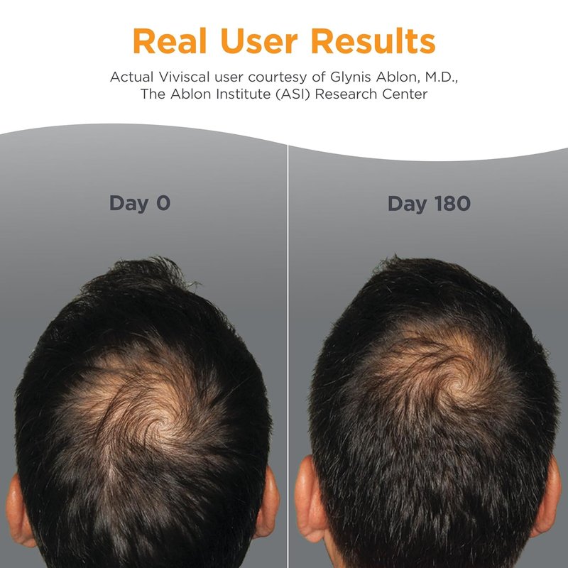 Viviscal Men's Hair Growth Supplements - Clinically Proven Collagen Complex | 180 Tablets for Thicker, Fuller Hair