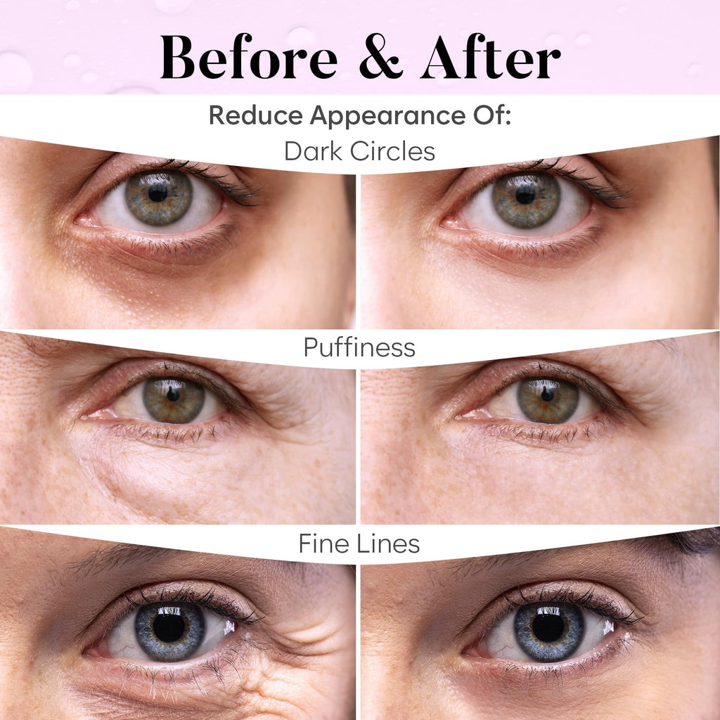 BLOOMORA PDRN, Caffeine & Collagen Under Eye Patches (30 Pairs), Under Eye Mask for Puffy Eyes, Appearance of Dark Circles, Smoothing & Hydration, Self Care & Skincare Gifts for Women, Patch Yeux