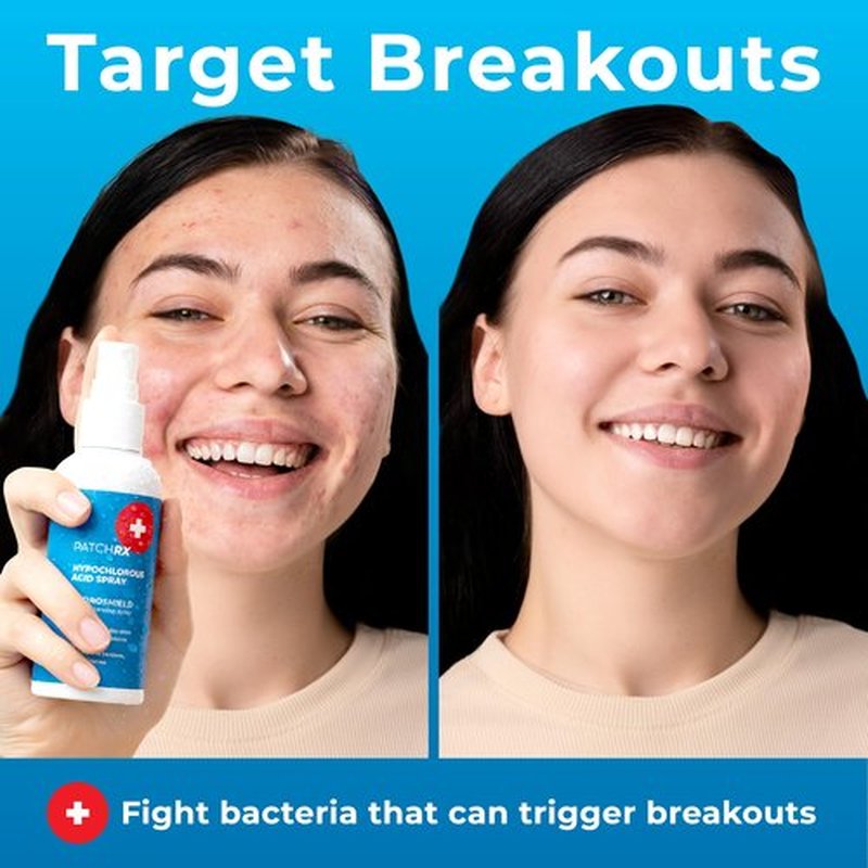 PatchRx Hypochlorous Acid Spray for Face (8oz, Reduces Acne), Targets Bacteria - HOCL Facial Cleanser Acne Spray for Face, Body, Eczema, Pimples, Breakouts & Overall Skin Recovery (Reduces Redness)