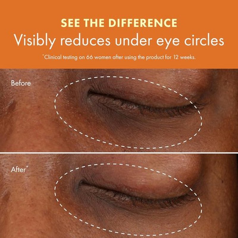Origins GinZing Brightening Eye Cream - Reduces Dark Circles with Vitamin C & Niacinamide | 0.5 Fl Oz