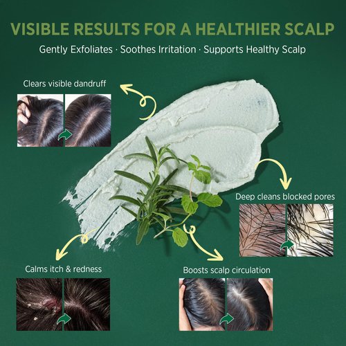 RoyceDerm Rosemary Mint Scalp Scrub Clarifying Scalp Exfoliator Refreshing Clean Scalp, Cooling Micro-Exfoliation with Botanical Extracts, For All Scalp Types (Rosemary Mint Scalp Scrub)