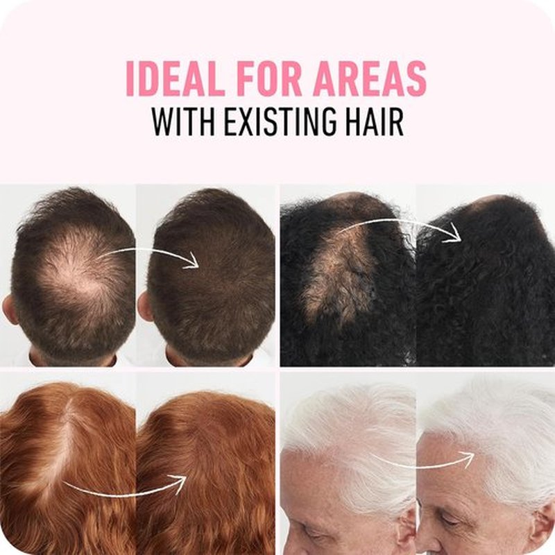 BOLDIFY Hair Fibers - Instantly Thicker Look for Thinning Hair | 28g - Black - 14 Shades Available