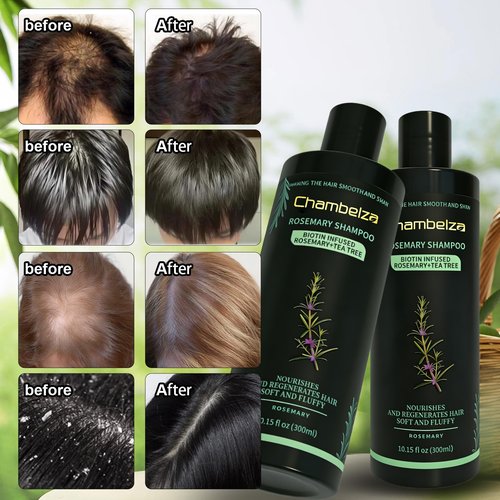 Chambelza Organic Rosemary Hair Growth Shampoo for Men and Women -Natural Thickening and Strengthening Formula with Biotin Hydrolyzed Keratin -Designed for Thinning Hair & Hair Loss 10.15 fl.oz-2 Pack