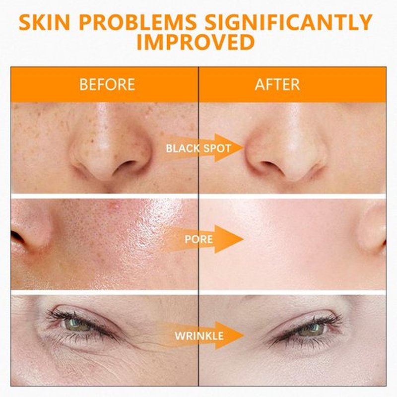 MAVENI Super Vitamin C Serum for Women over 70 With Hyaluronic Acid, Reduce Wrinkle, Hydrates, Firms, Lifts, Anti Aging Serum for Dark Spots, Wrinkles, DullSkin, 1 fl.oz.