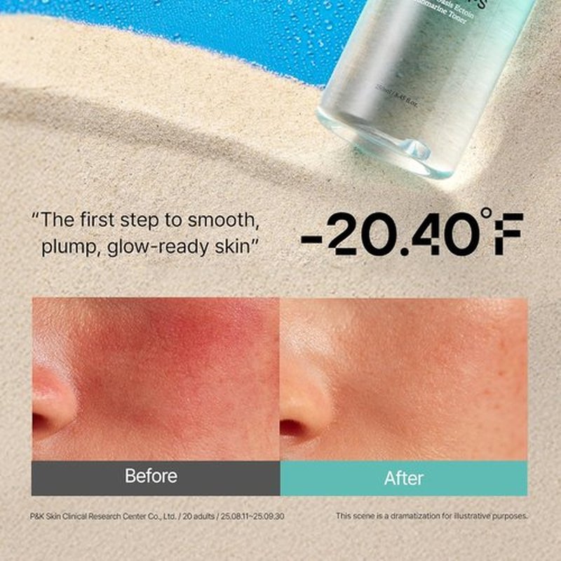 Ectoin Calming Toner by Overlaps - Redness Relief & Barrier Repair for Sensitive Skin | Hydrating Glass Skin with Hyaluronic Acid & Panthenol | 8.45 fl. oz.