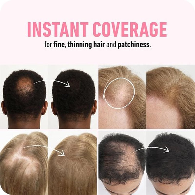 BOLDIFY Hair Fibers - Instantly Thicker Look for Thinning Hair | 28g - Black - 14 Shades Available