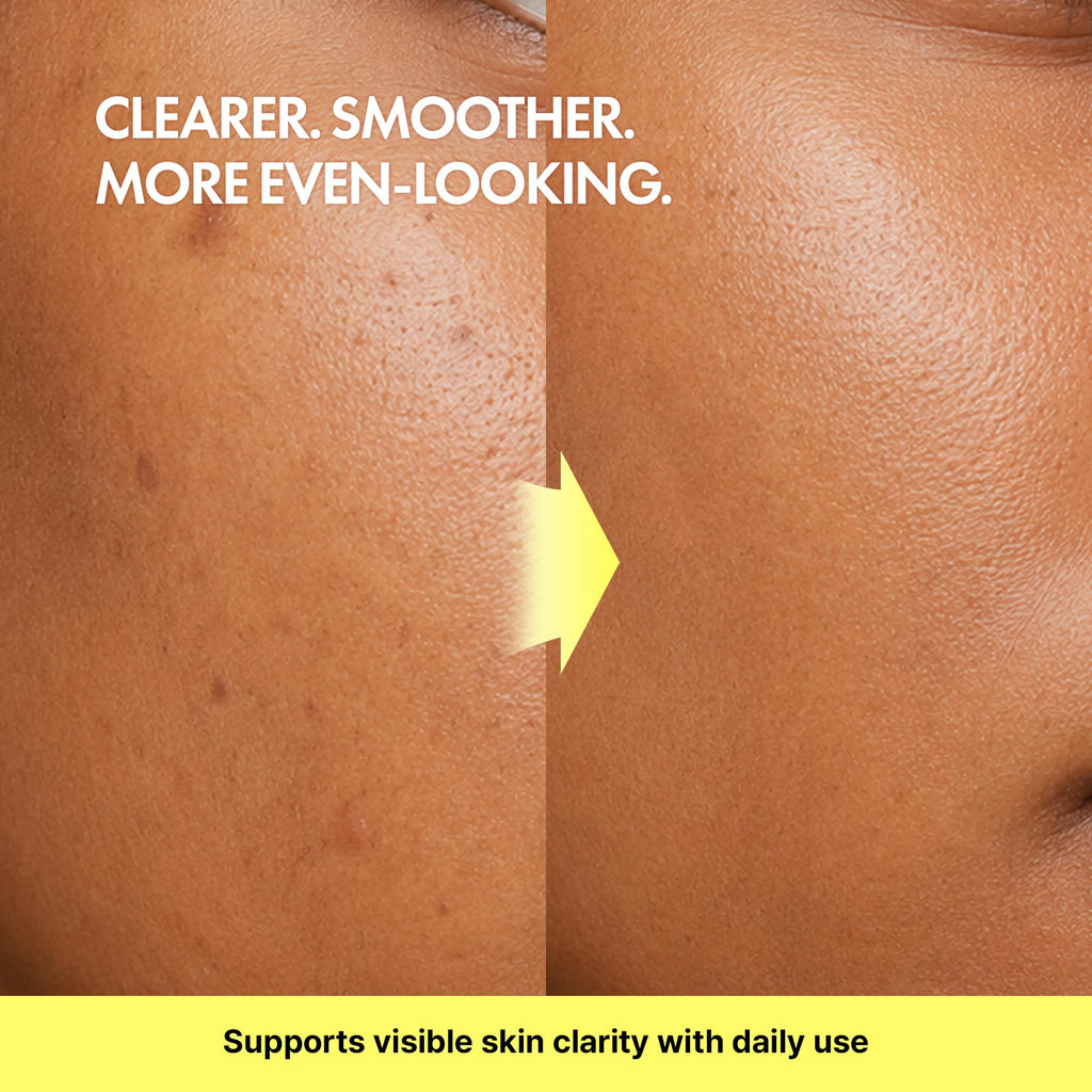 TIAM Vita B3 Source Serum, Niacinamide 10% + Arbutin 2%, Charming Tone Maker Tone-Balancing Treatment for Uneven Skin Tone, Dark Spot Care & Skin Clarity, Lightweight Daily Facial Formula, 1.35 fl oz