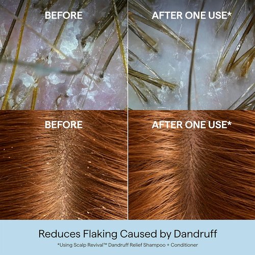 Briogeo Scalp Revival Dandruff Relief Shampoo - Charcoal & 3% Salicylic Acid | Daily Anti-Dandruff Care | 8.4 fl oz