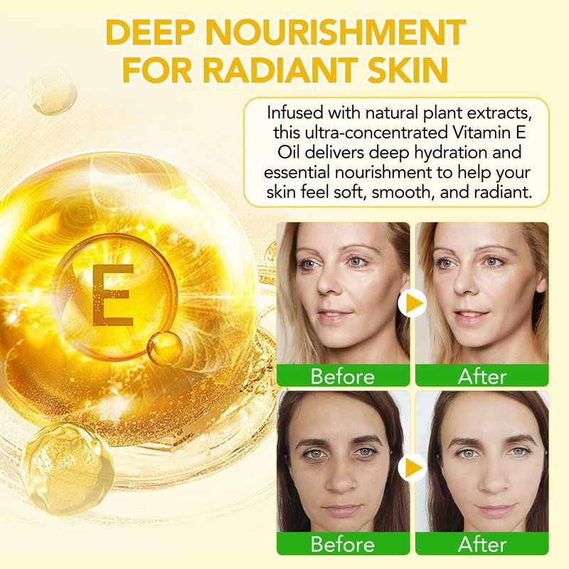 Vitamin E Oil for Skin 75,000 IU, 2Fl Oz Pure Vitamin e Oil for Scars, Hair, Face and Scalp, Moisturizing Dry Skin, Reduces Winkles and Fine Lines, Perfect Bath and Body Oils