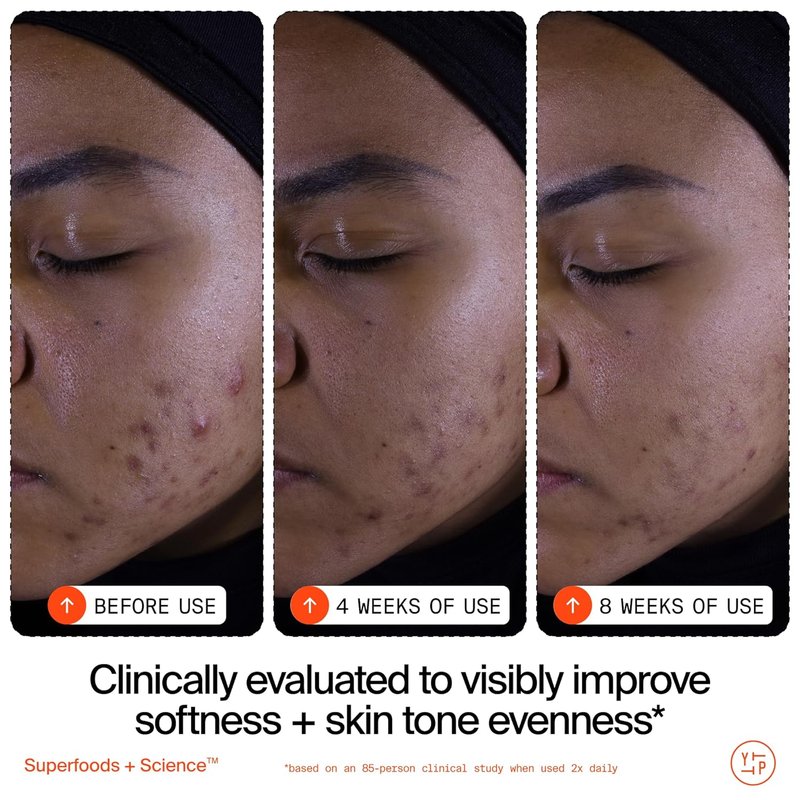 Youth To The People Superfruit Facial Cleanser - Gentle Exfoliating Face Wash with Papaya & Vitamin C for Radiant Skin | AHA + BHA Formula, Sulfate-Free