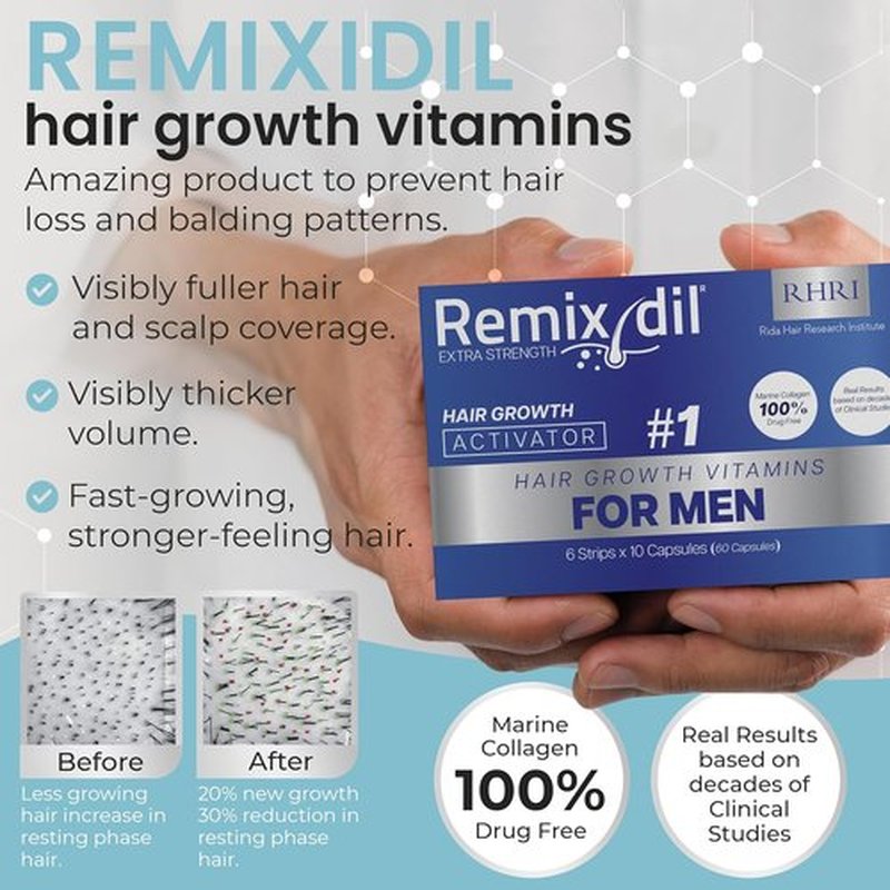 Hair Growth Vitamins - Regrow Hair for Men | Strengthens Beard & Scalp | Reduces Thinning | 60 Fast-Acting Capsules