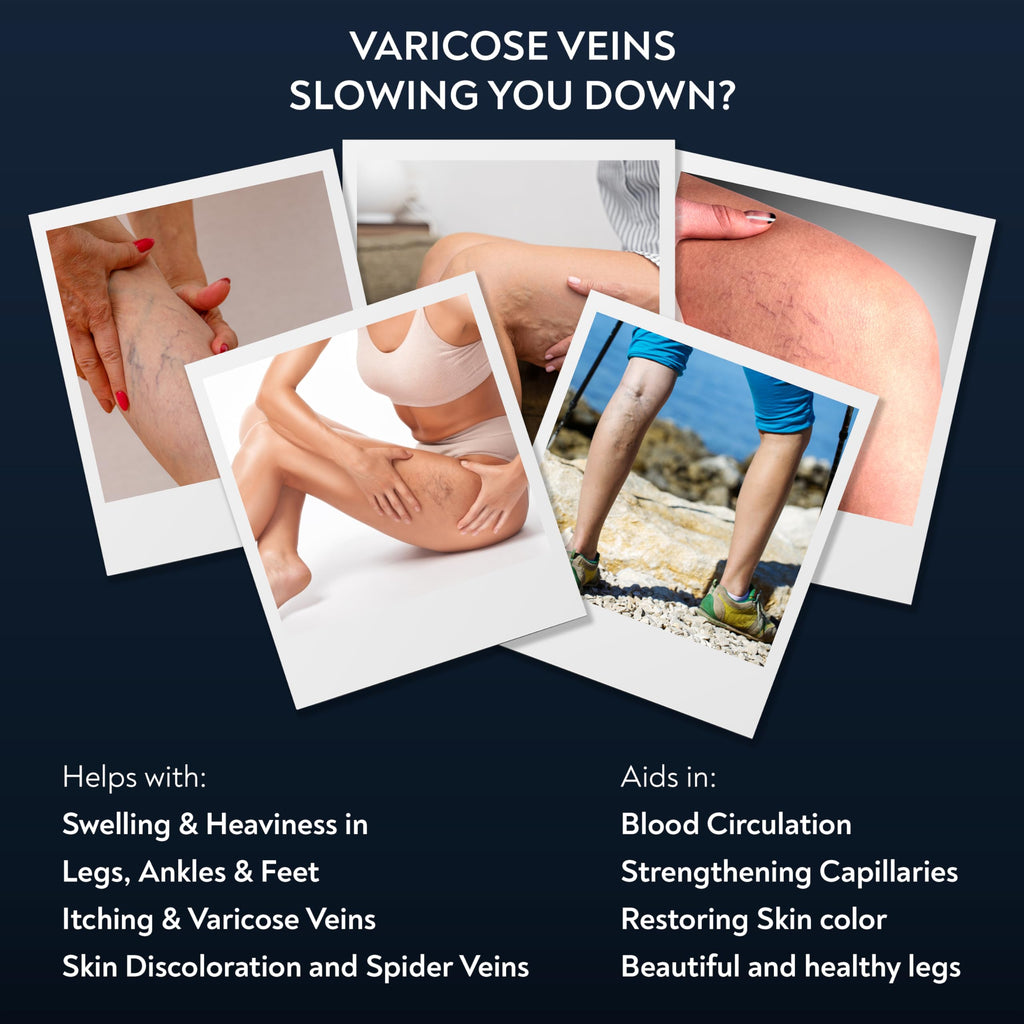 PENIKOSETE Varicose & Spider Vein Cream for Legs | Dermatologically Tested Ayurvedic Ashwagandha Formula | Natural Non-Sticky Cream for Tired, Swollen & Heavy-Looking Legs | For Men & Women - 1 Pack