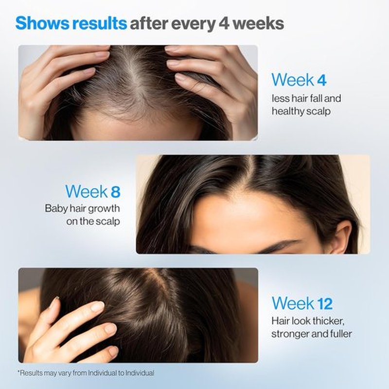 Be Bodywise Rosemary Hair Growth Serum - DHT-Blocking Roll-On with 3% Rosemary & Redensyl | 50 ml | Paraben/Sulfate-Free for Men & Women