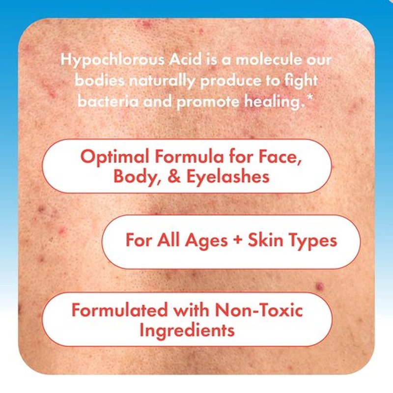 Hypochlorous Acid Spray for Face, Skin & Eyelids – pH-Balanced HOCl Facial Spray Safe for Acne, Red & Sensitive Skin – Gentle Non-Toxic Toner & Cleanser Mist for Clear, Hydrated Skin, 8 oz