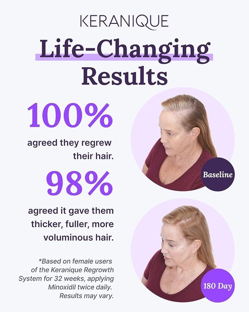 Keranique Hair Regrowth Treatment for Women - 2% Minoxidil Topical Solution for Thinning Hair - 2 Fl Oz
