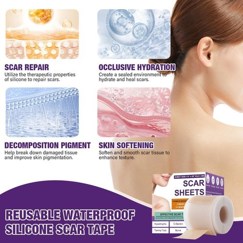 Silicone Scar Sheets,Silicone Scar Tape,Silicone Scar Removal Strips for Surgical,C-Section,Tummy Tuck,Keloid Scars (1.6"X 157" Roll-4M) Keloid Bump Removal