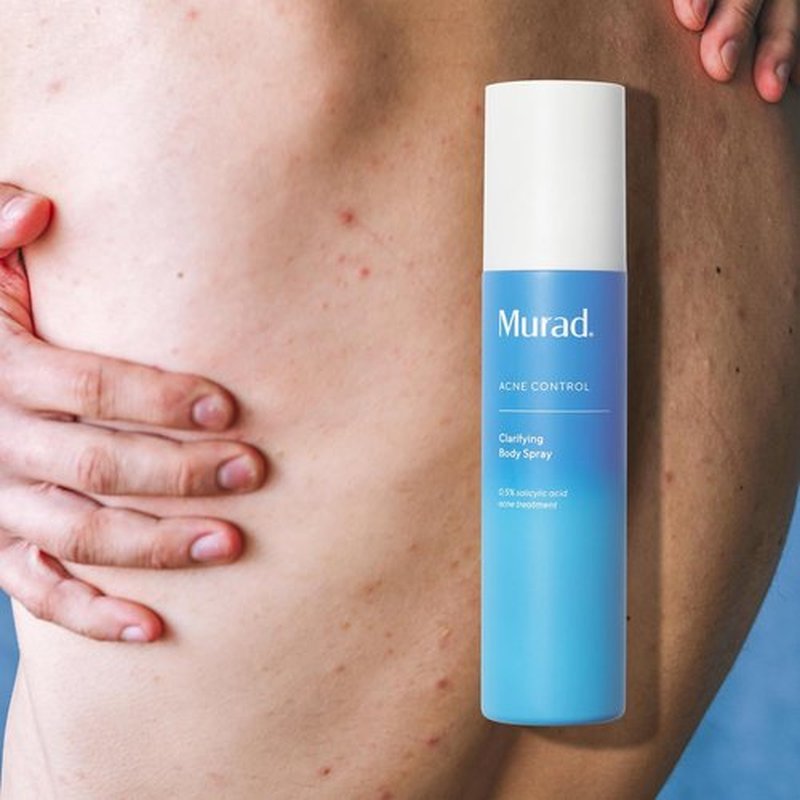 Murad Clarifying Body Spray - Salicylic Acid Treatment for Bacne & Body Acne Prevention | Non-Drying Formula